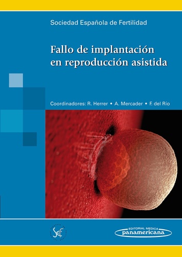 Fallo de implantación en reproducción asistida - SEF Sociedad Española de Fertilidad