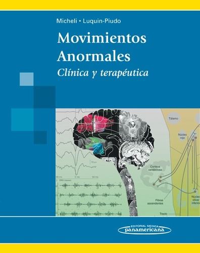 Movimientos Anormales - Federico E. Micheli