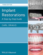 IMPLANT RESTORATIONS: A STEP-BY-STEP GUIDE 3rd EDITION - DRAGO
