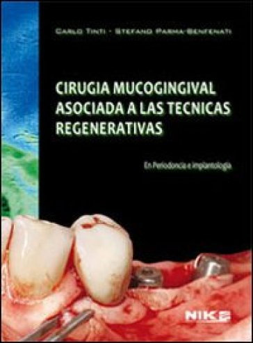 Cirugía Mucogingival asociada con técnicas regenerativas en Periodoncia e Implantología - Tinti / Benfanti