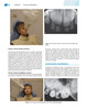 Odontología para el Niño y Adolescente - McDonald / Avery