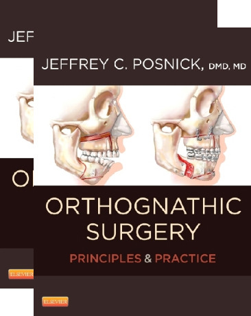 PRINCIPLES AND PRACTICE OF ORTHOGNATHIC - Posnick 2 Vols.