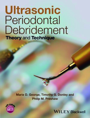 Ultrasonic Periodontal Debridement: Theory and Technique - George / Preshaw / Donley