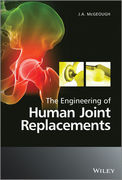 The Engineering of Human Joint Replacements - McGeough