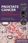 Prostate Cancer: Diagnosis and Clinical Management - Whelan / K. Tewari / D. Graham