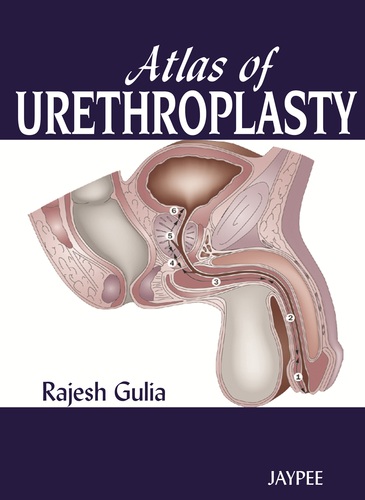 Atlas of Urethroplasty - Rajesh Gulia