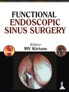 Functional Endoscopic Sinus Surgery - MV Kirtane