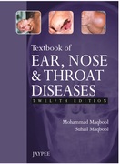 Textbook of Ear, Nose and Throat Diseases - Maqbool / Maqbool