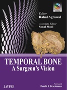 Temporal Bone - Rahul Agrawal