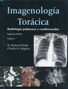 Imagenología Torácica. Radiología pulmonar y cardiovascular. 2 Vols - Webb