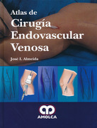 Atlas de cirugía endovascular venosa - Almeida