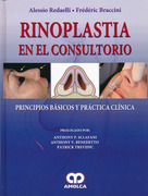 Rinoplastia en el Consultorio - Redaelli