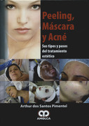 Peeling, mascara y acné. Sus tipos y pasos del tratamiento estético - dos Santos Pimentel 
