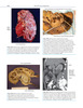 Atlas de Anatomía Uroquirúrgica de Hinman - MacLennan