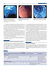 Atlas de endoscopia digestiva de la Sobed. 2 Vols + DVD - Averbach