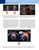 Ultrasonografia del cerebro prenatal - Timor-Tritsch / Monteagudo / Pilu / Malinger