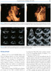 Ecografia fetal de semana 18-22 de embarazo + DVD. Vol III. - Gallo y otros 
