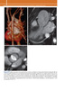 Fundamentos de imagenologia cardiovascular + DVD - Koster