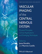 Vascular Imaging of the Central Nervous System: Physical Principles, Clinical Applications and Emerging Techniques - Joana Ramalho / Mauricio Castillo
