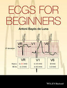 ECGs for Beginners - Antoni Bayes de Luna
