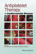 Antiplatelet Therapy in Cardiovascular Disease - Waksman / A. Gurbe / A. Gaglia, Jr.