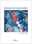 Estenosis de canal lumbar - F. Villarejo Ortega