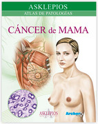 Atlas de cáncer de mama - Rojas Bautista / Equipo Médico Asklepios