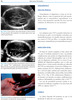 Infecciones Perinatales - Gallo / Cifuentes (Medicina Fetal y Perinatal Vol. 11)
