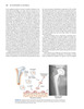 Artritis y Artroplastia – Rodilla - Brown / Cui / Mihalko / Saleh