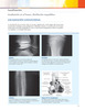 Guía Visual de Tumores Musculoesqueléticos - Wodajo / Murphey / Gannon