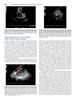 Ecocardiografía en enfermedad cardiaca congénita pediátrica y de adultos - W. Eidem / Cetta / W. O′Leary