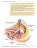 Tratamiento Quirúrgico de Prolapso de órganos pélvicos - Karram / F. Maher