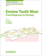 Erosive Tooth Wear From Diagnosis to Therapy - Lussi / Ganss
