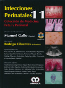 Infecciones Perinatales - Gallo / Cifuentes (Medicina Fetal y Perinatal Vol. 11)