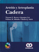 Artritis y Artroplastia Cadera - E. Brown / Cui / Mihalko / Saleh