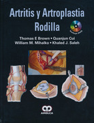 Artritis y Artroplastia – Rodilla - Brown / Cui / Mihalko / Saleh