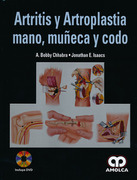 Artritis y Artroplastia Mano, Muñeca y Codo - Bobby Chhabra