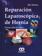 Reparación Laparoscópica de Hernia - R.K.Mishra