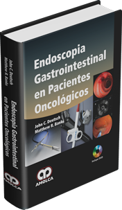 Endoscopia Gastrointestinal en Pacientes Oncológicos - Deutsch / Banks