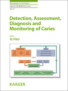 Detection, Assessment, Diagnosis and Monitoring of Caries - Pitts