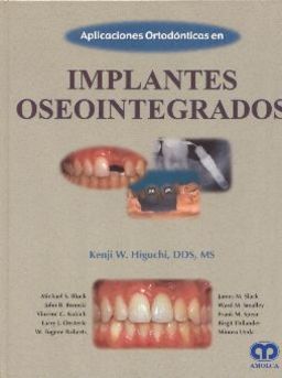 Aplicaciones ortodonticas en implantes oseointegrados - Higuchi