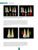 Arte de la Ortodoncia Aplicada Vol. II y II - Ezequiel Rodriguez Yánez