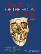 Fractures of the Facial Skeleton, 2nd Edition - Perry/ Brown/ Banks