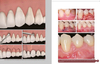 EVIDENCE-BASED PERIODONTAL AND PERI-IMPLANT PLASTIC SURGERY. A CLINICAL ROADMAP FROM FUNCTION TO AESTHETICS - Chambrone