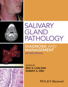 SALIVARY GLAND PATHOLOGY DIAGNOSIS AND MANAGEMENT 2ND - Carlson / Ord