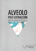 ALVEOLO POST-EXTRACCION UNA APROXIMACION BIOLOGICA - Anitua