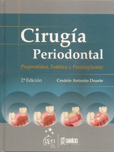 CIRUGIA PERIODONTAL - Duarte