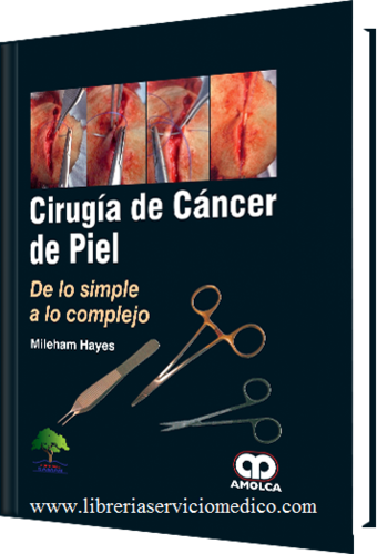 CIRUGIA DE CANCER DE PIEL - Hayes