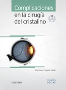 COMPLICACIONES EN LA CIRUGÍA DEL CRISTALINO + ACCESO WEB: MONOGRAFÍAS SECOIR -  Francisco Poyales Galán