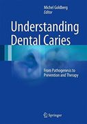 UNDERSTANDING DENTAL CARIES FROM PATHOGENESIS TO PREVENTION AND THERAPY - Michel Goldberg
